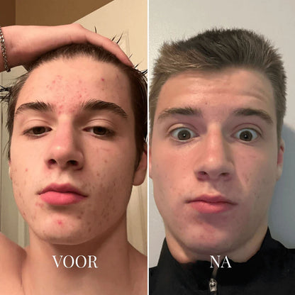 PureLisse™ Poriënreiniger