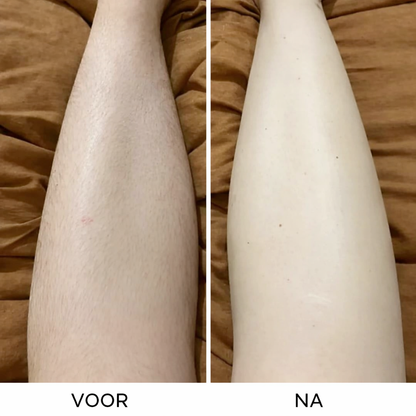 Silkéra™ Precision Hair Remover